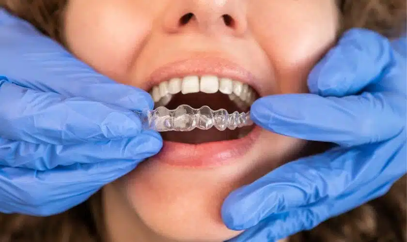 Featured image for “Embraces The Future of Orthodontics With Invisalign Aligners”