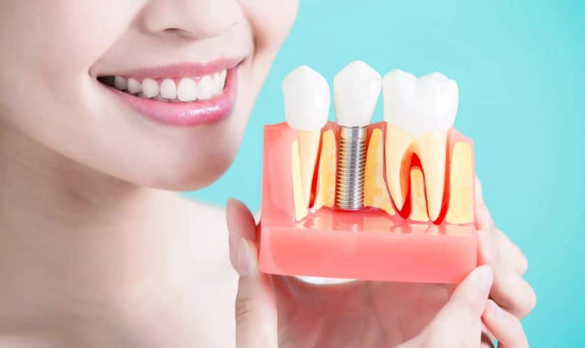 Featured image for “Important Factors to Consider Before Getting Dental Implants”
